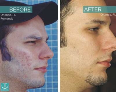 Before and After Treatment