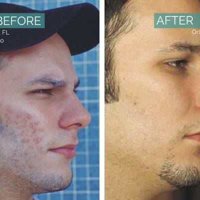 Before and After Treatment