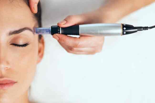Microneedling for acne scars Microneedling for acne scars